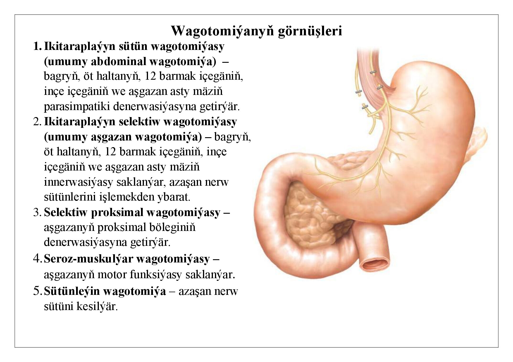WAGOTOMIÝANYŇ GÖRNÜŞLERI