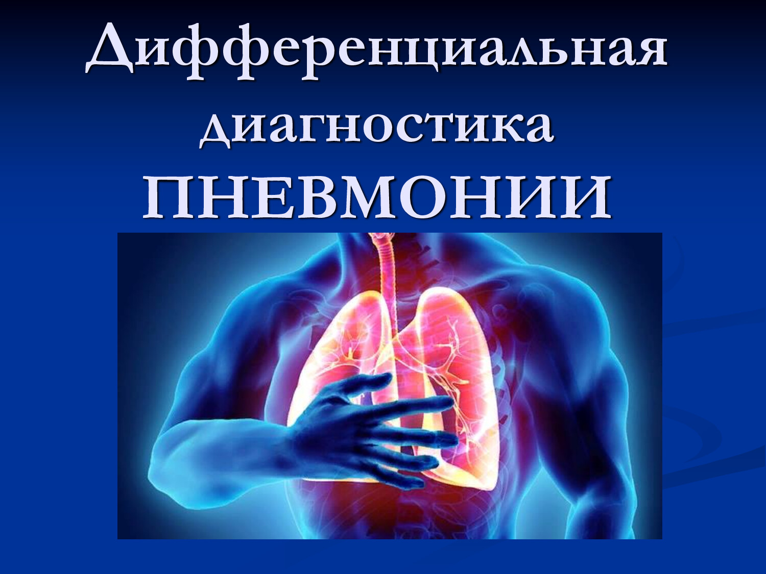 ДИФФЕРЕНЦИАЛЬНАЯ ДАГНОСТИКА ПНЕВМОНИИ