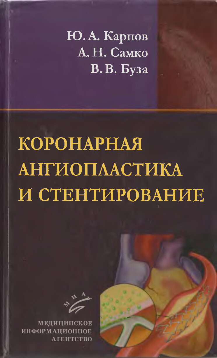 КОРОНАРНАЯ АНГИОПЛАСТИКА И СТЕНТИРОВАНИЕ