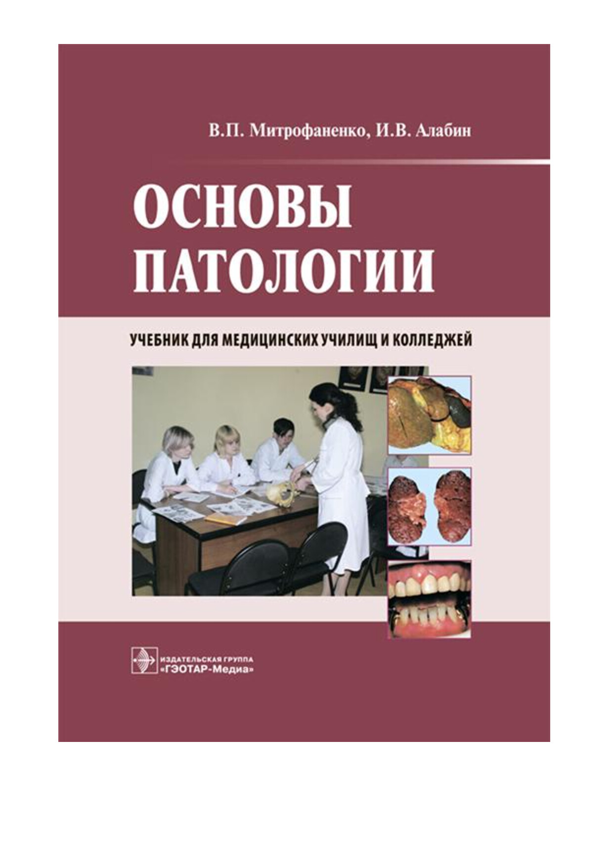 МИТРОФАНЕНКО В.П., АЛАБИН И.В. ОСНОВЫ ПАТОЛОГИИ