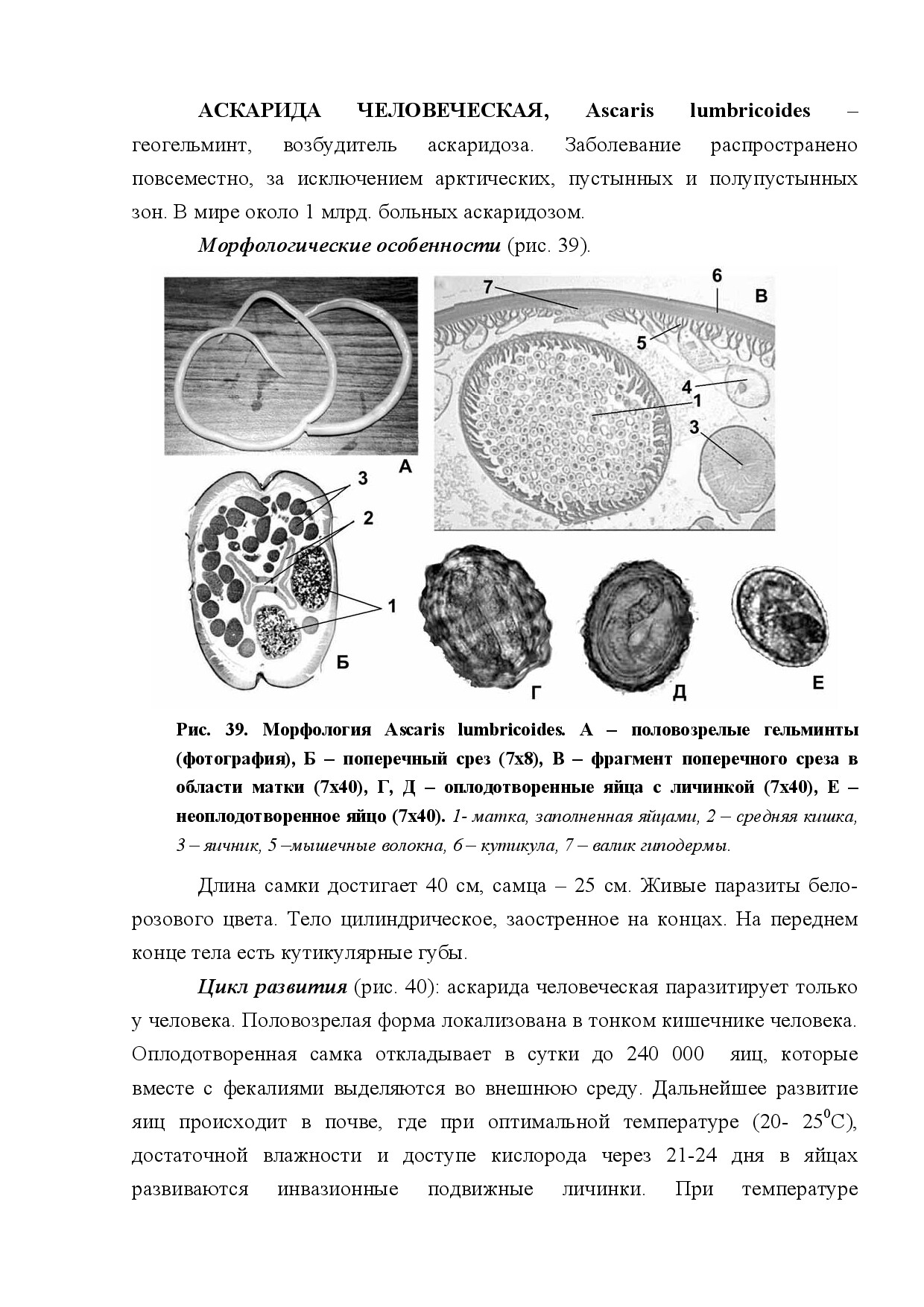 АСКАРИДА ЧЕЛОВЕЧЕСКАЯ (ASCARIS LUMBRICOIDES)