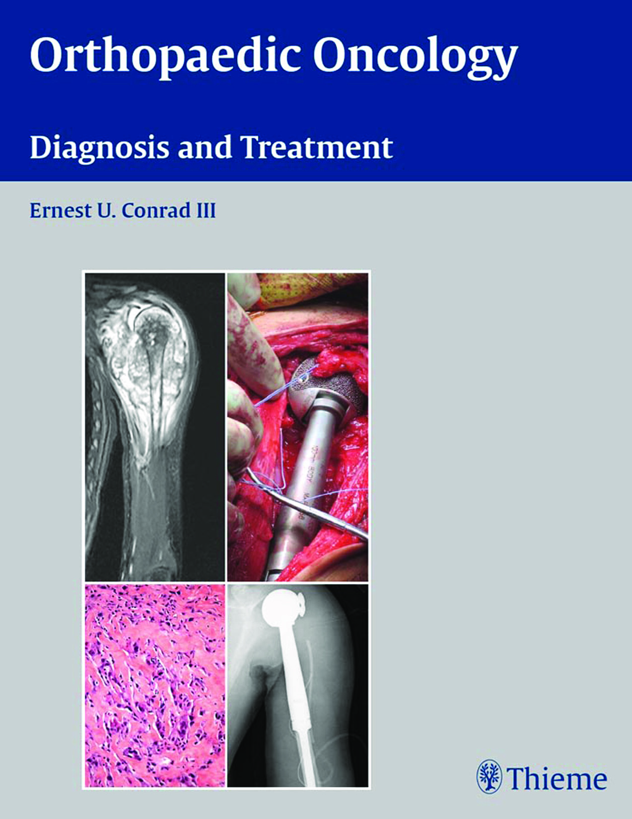 ORTHOPAEDIC ONCOLOGY