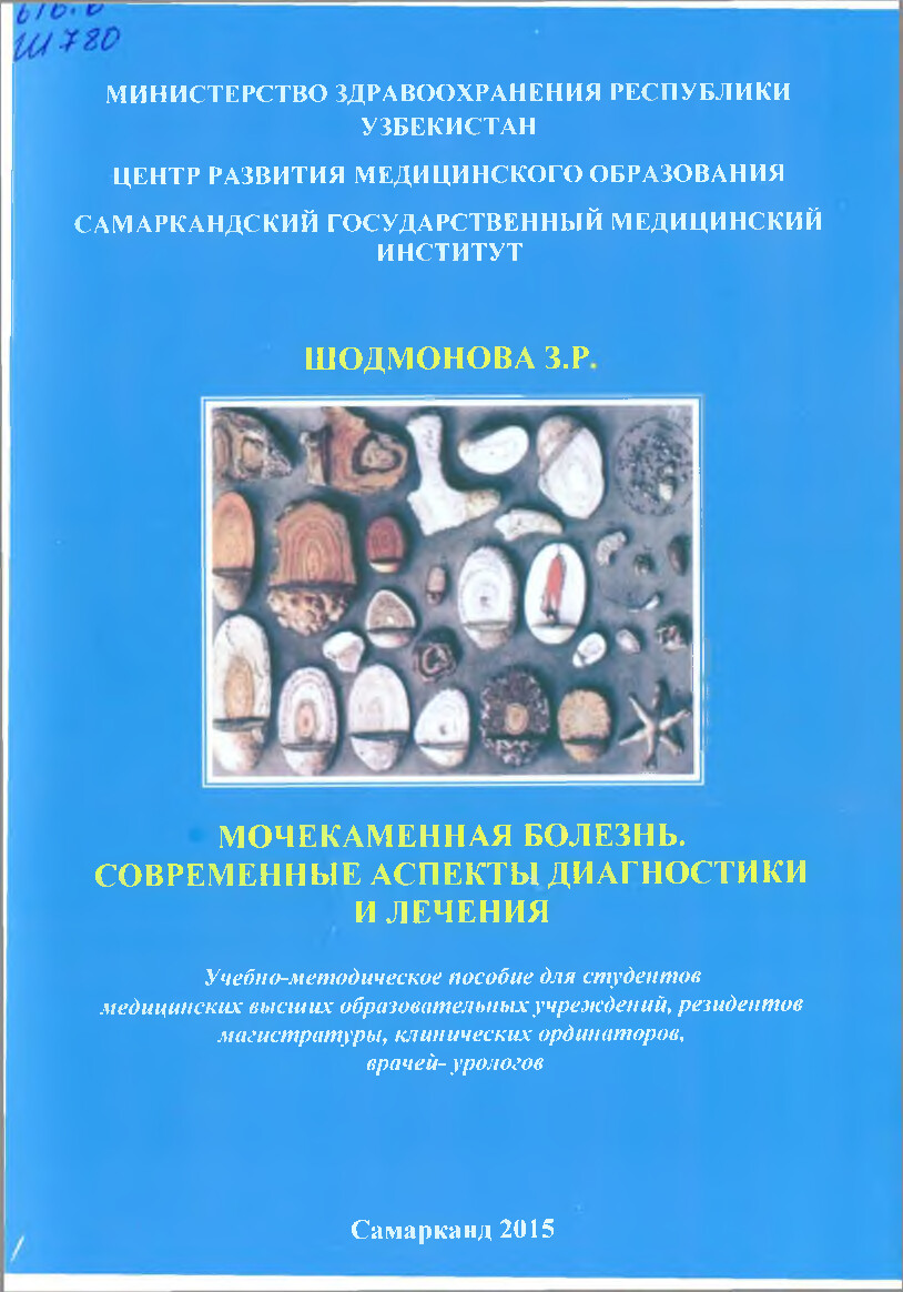 МОЧЕКАМЕННАЯ БОЛЕЗНЬ