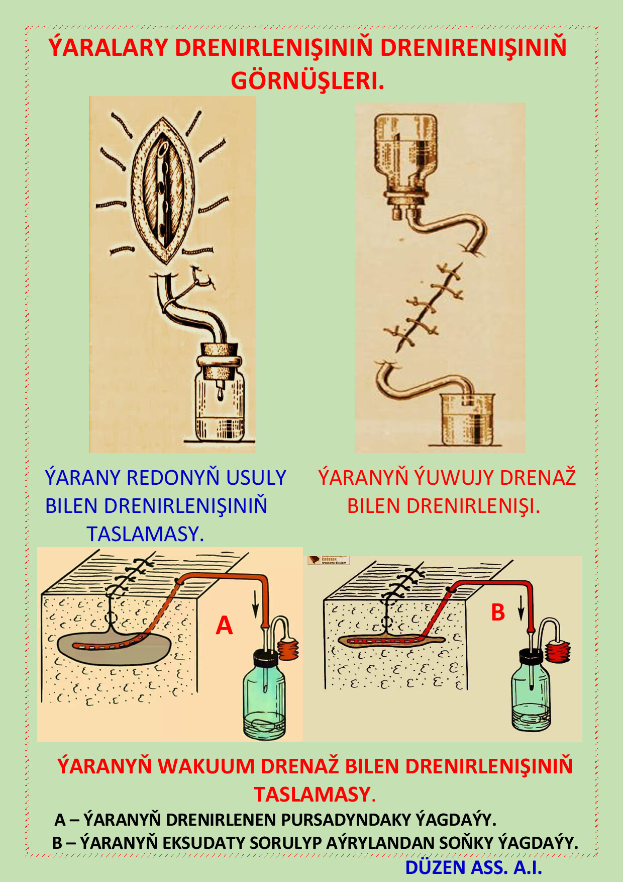 46. WAKUUM DRENIRLEMEK