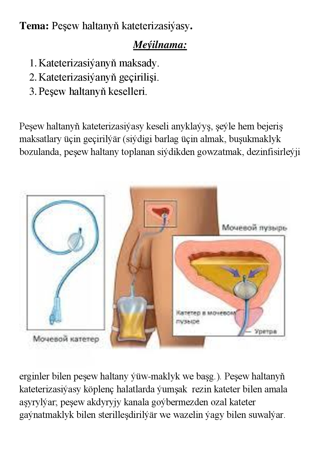 REFERAT PEŞEW HALTANYŇ KATETERIZASIÝASY