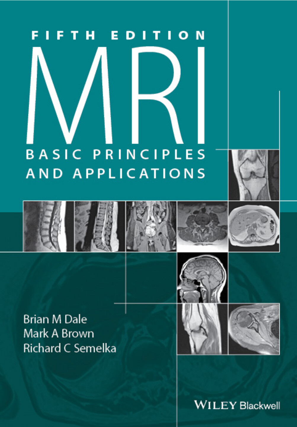 MRI BASIC PRINCIPLES AND APPLICATIONS