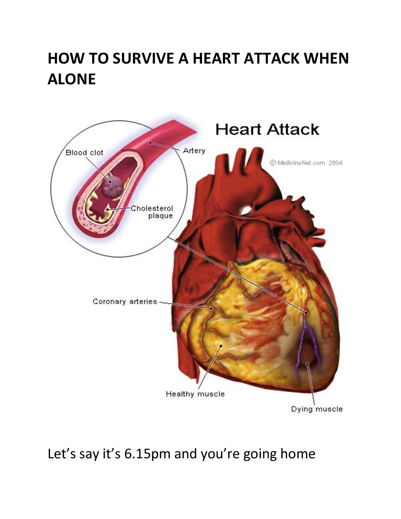 HOW TO SURVIVE A HEART ATTACK WHEN ALONE