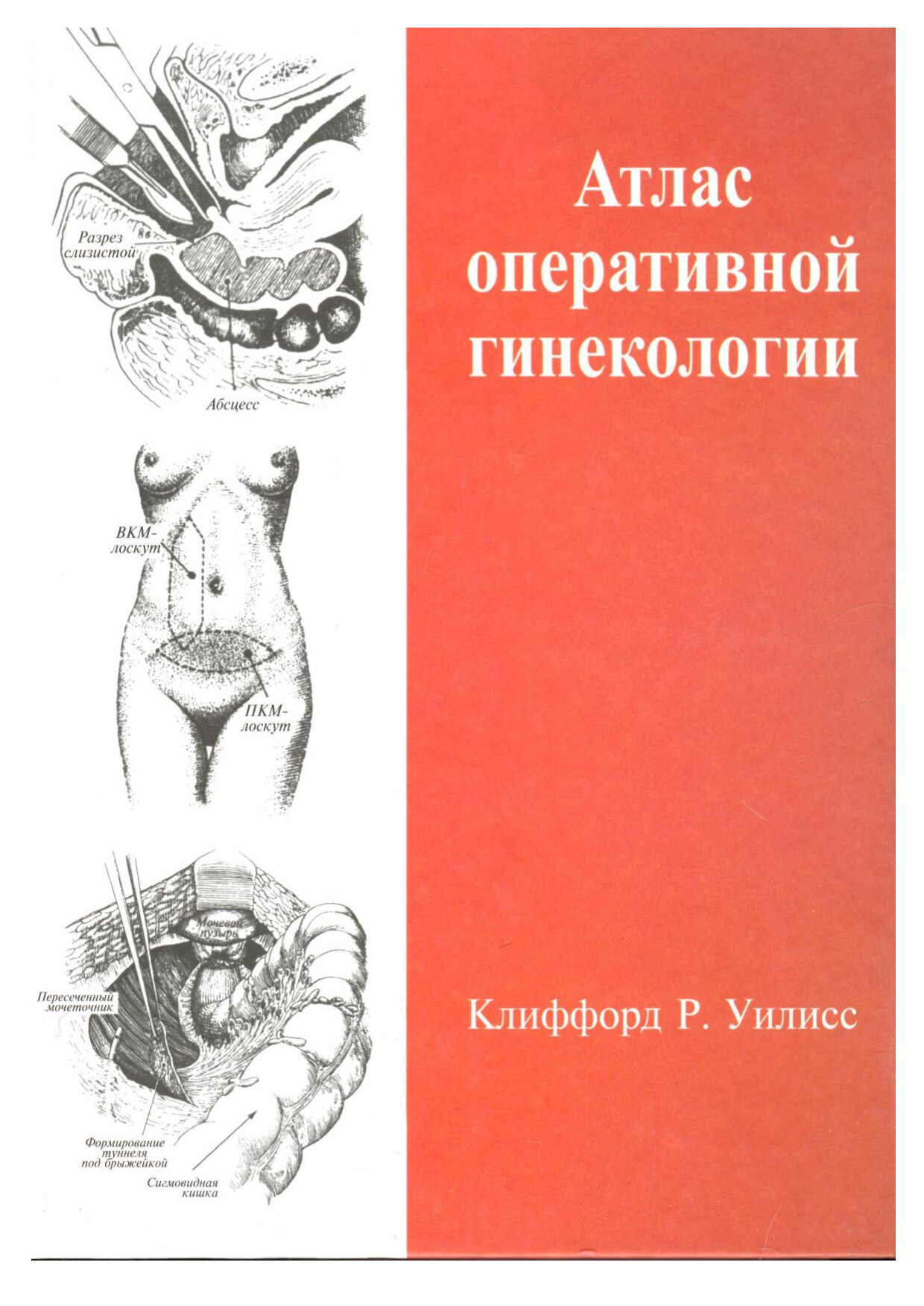 АТЛАС ОПЕРАТИВНОЙ ГИНЕКОЛОГИИ   УИЛЛИСС (2004)