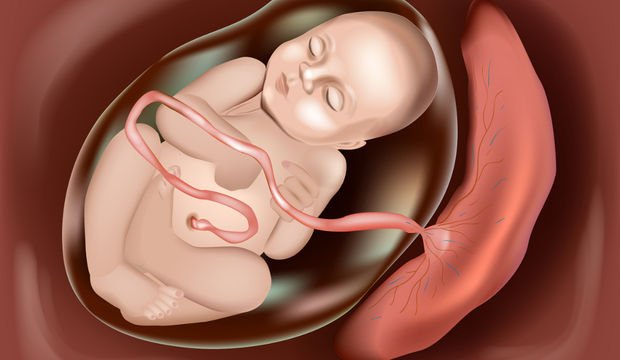 Plasentanyň aşakda ýerleşmegi