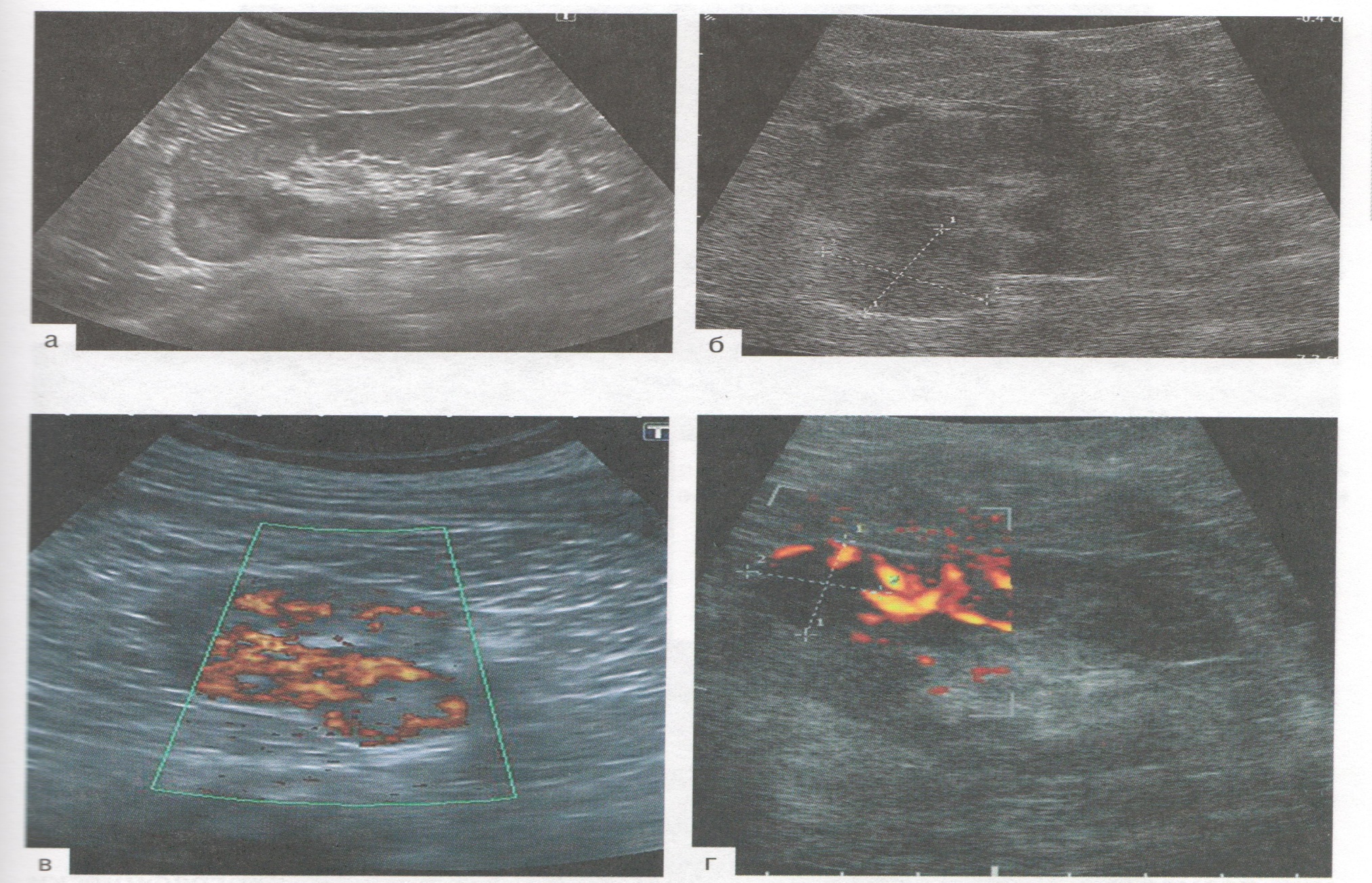 Peşew  - jyns agzalarynyň täze  döremeleri