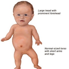 Süňk skeletinden geçýän keseller