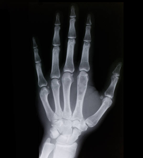 BONEFACTS