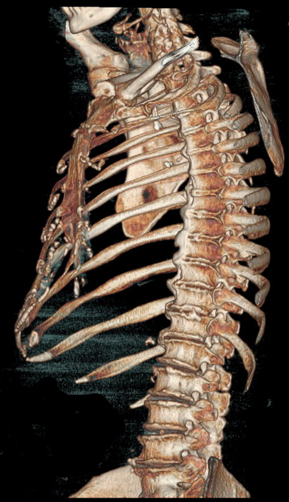 Rentgen barlagy. rentgenoskopiýa, rentgenografiýa, kompýuter tomografiýasy, flýurografiýa