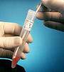 DNA FINGERPRINTING