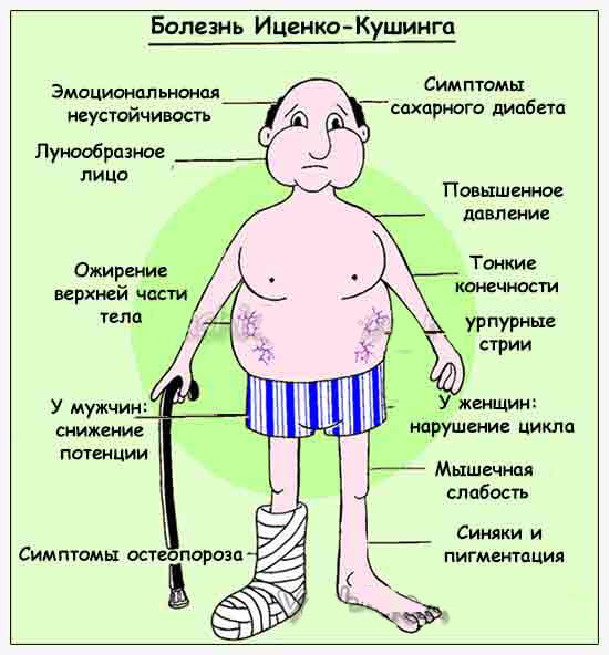 Isenko-kuşinga keseli we sindromy
