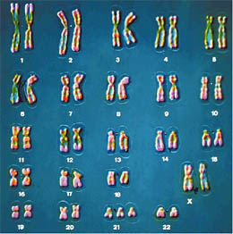 MEIOSIS 1