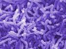 Cholera 1
