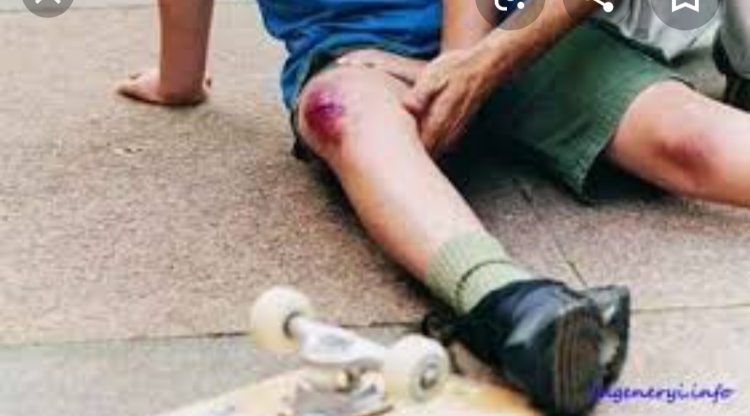 Ýumşak dokumanyň şikesleri