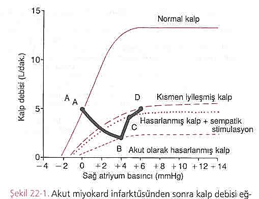 Şok ve Kalp Yetmezliği